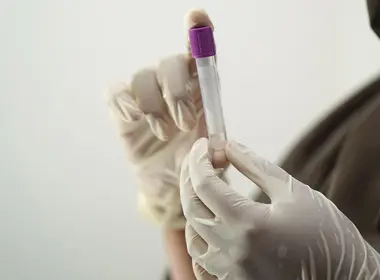 El análisis de sangre que podría saber si tienes Alzheimer