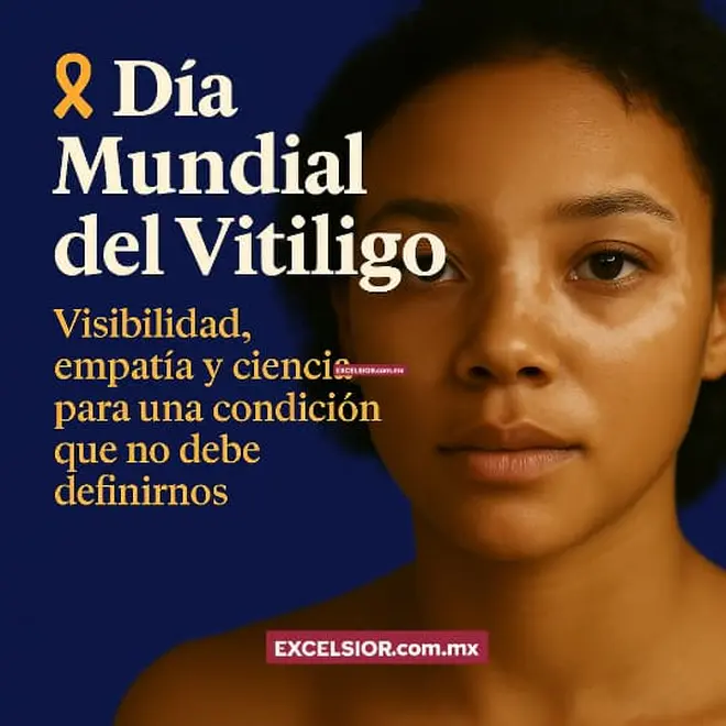 Imagen intermedia