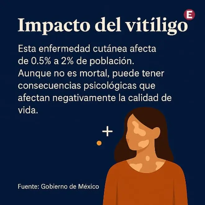 Imagen intermedia
