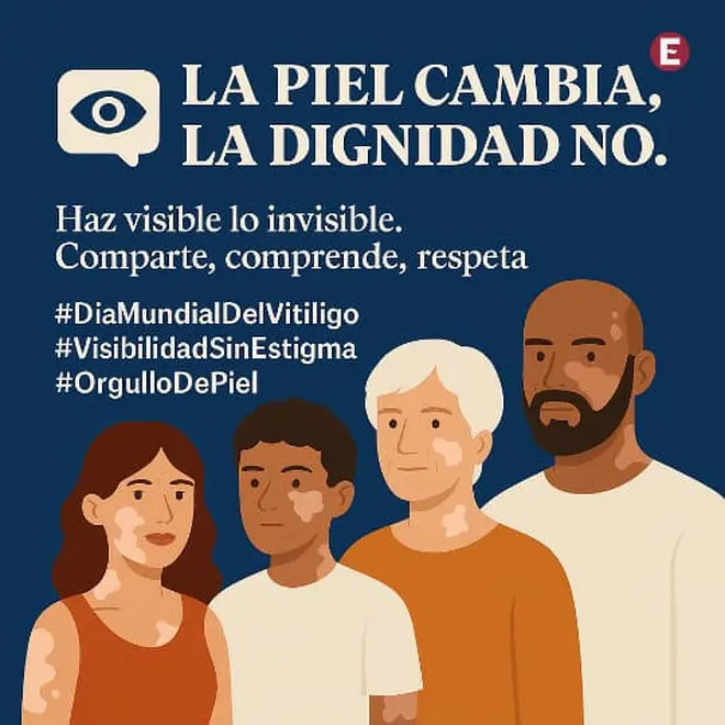 Imagen intermedia