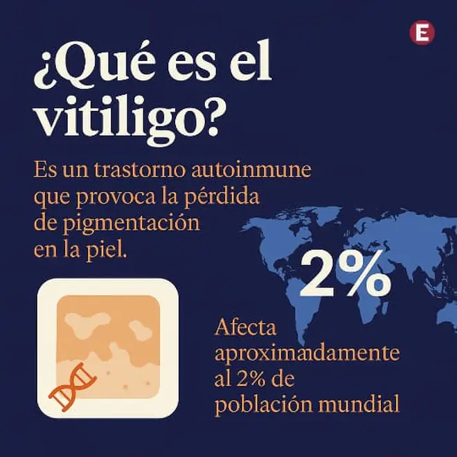 Imagen intermedia