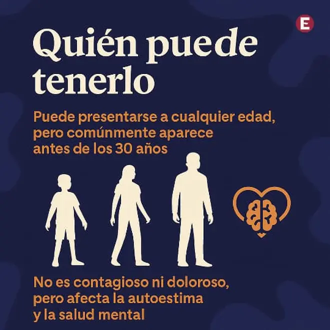 Imagen intermedia
