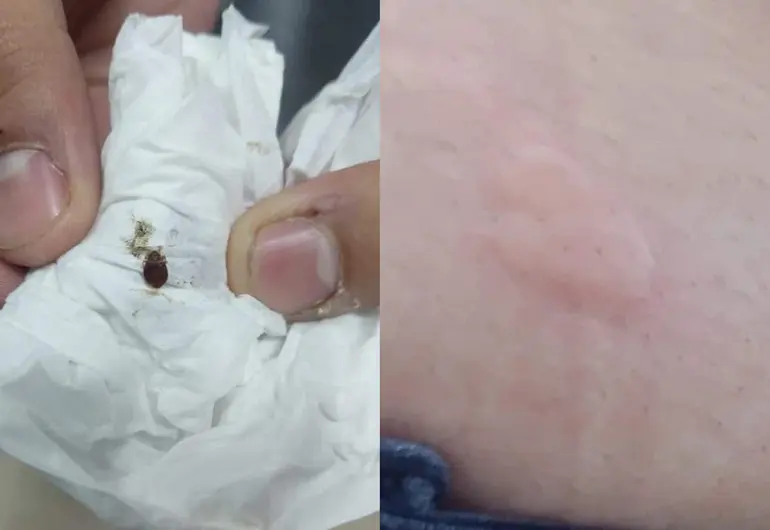 (FOTOS) Alumnos UNAM demuestran plaga de chinches y piquetes
