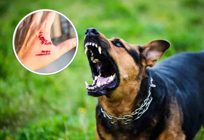 Me pueden demandar si mi perro muerde a una persona o perro