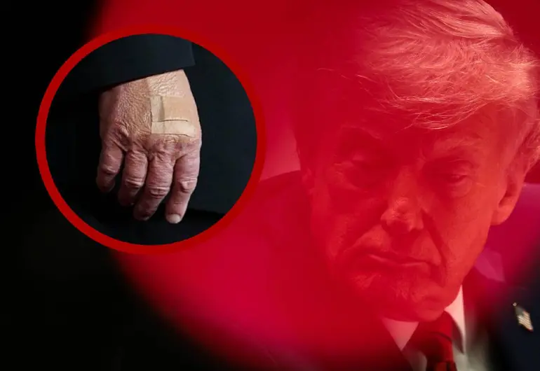 Trump tiene la mano vendada por dar muchos apretones: Casa Blanca