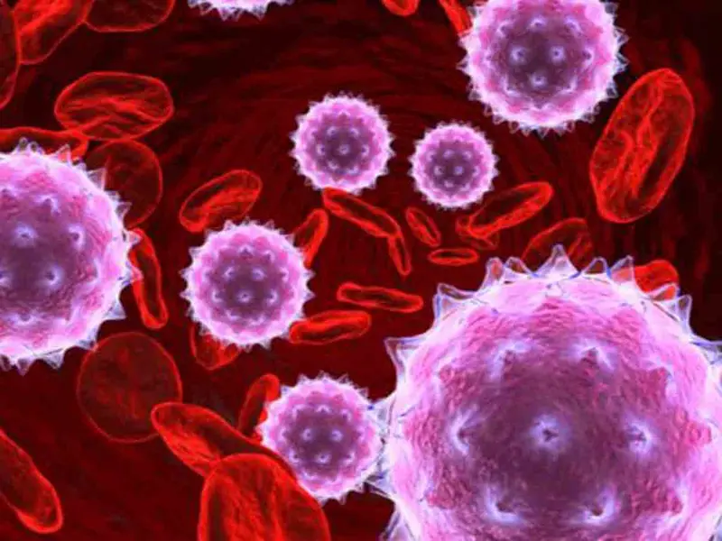 Repuntan casos de VIH en México