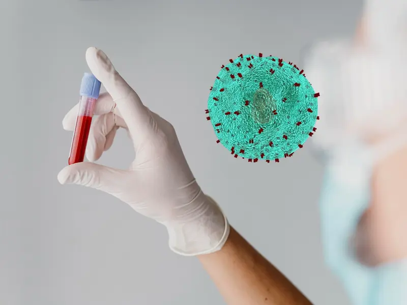 VIH y SIDA: éstas son las diferencias entre las enfermedades, cómo se ...