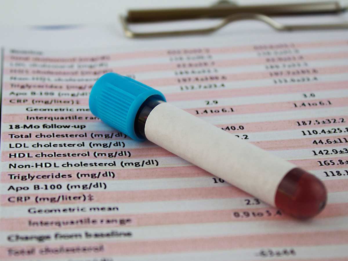 Qué es una química sanguínea y qué significan sus elementos