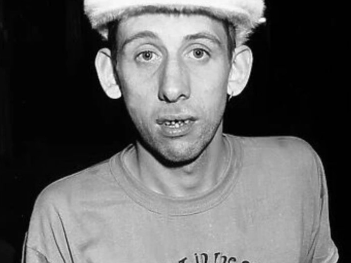 Sorriso de Dar Medo #18: Shane MacGowan - Medo de Dentista
