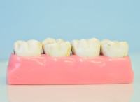 La Secretaría de Salud expone que el uso de la nicotina en polvo puede derivar en la pérdida de dientes. Foto: Pixabay